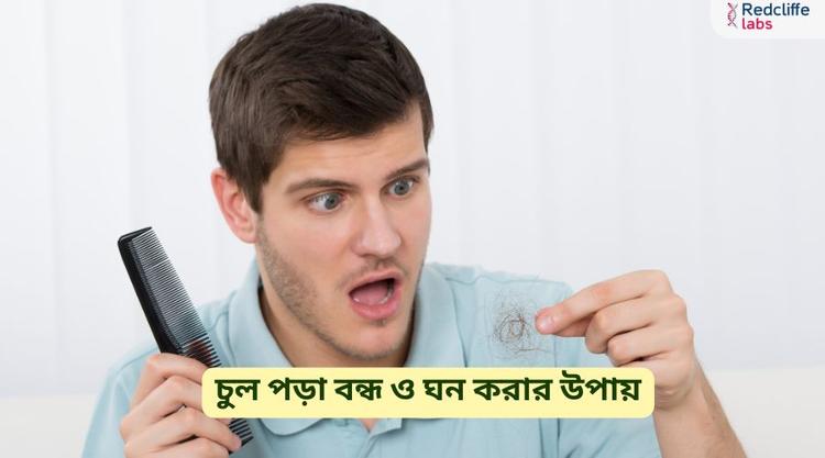 চুল পড়া বন্ধ ও ঘন করার উপায় - ঘরোয়া প্রতিকার ও কার্যকর টিপস