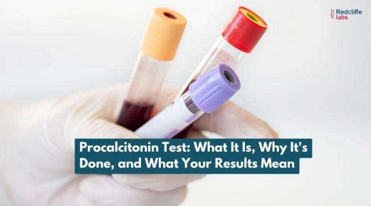 Procalcitonin Test: What It Is, Why It's Done, and What Your Results Mean