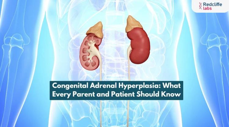 Congenital Adrenal Hyperplasia: What Every Parent and Patient Should Know