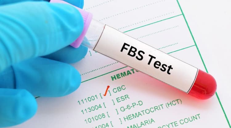 Frequency and Timing: When to Get an FBS Test