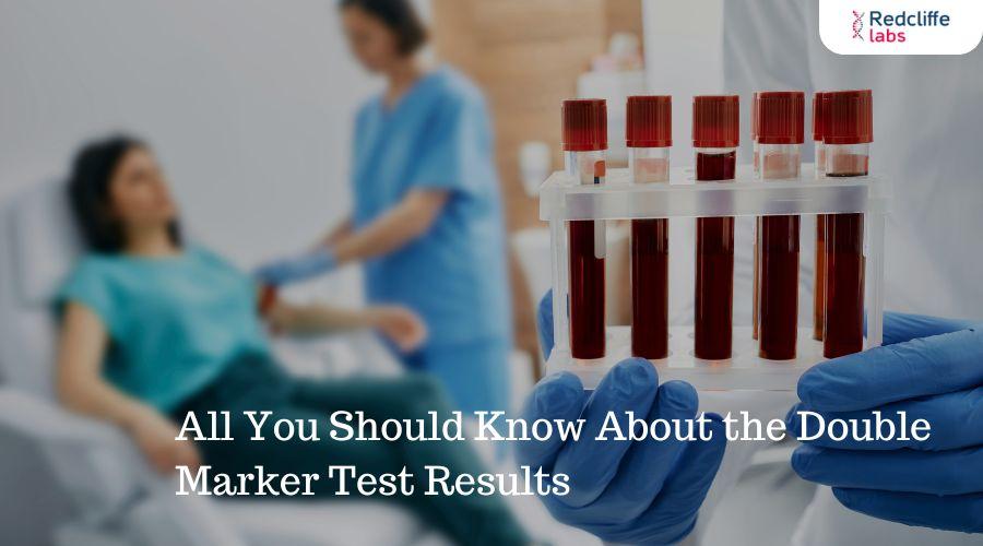 Marker Test All You Should Know About the Double Marker Test Results