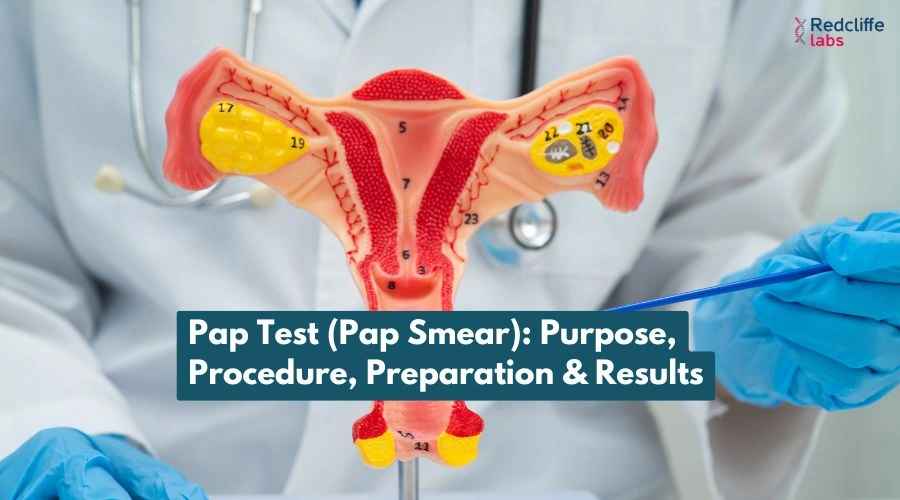 https://myhealth-redcliffelabs.redcliffelabs.com/media/blogcard-images/None/2113c483-2faf-4903-92ef-0b3253dccb89.webp