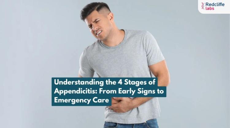 Understanding the 4 Stages of Appendicitis: From Early Signs to Emergency Care