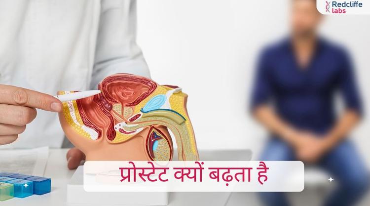 प्रोस्टेट क्यों बढ़ता है? कारण, लक्षण और इलाज