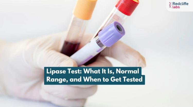 Lipase Test: What It Is, Normal Range, and When to Get Tested