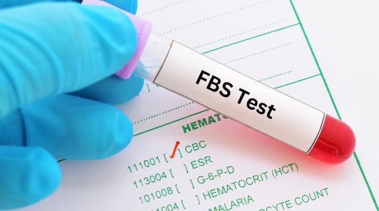 FBS Test in Hindi: FBS टेस्ट कब और कैसे किया जाता है
