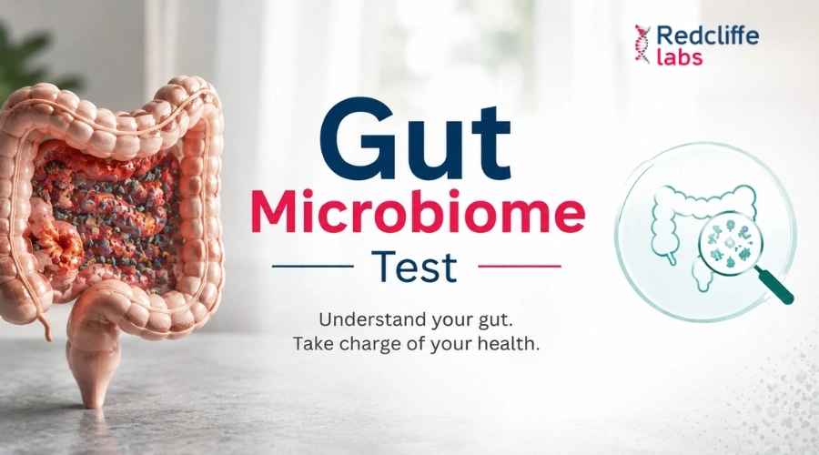https://myhealth-redcliffelabs.redcliffelabs.com/media/blogcard-images/None/2fe2467b-df09-45fe-b97f-0d0dba2c78f8.webp