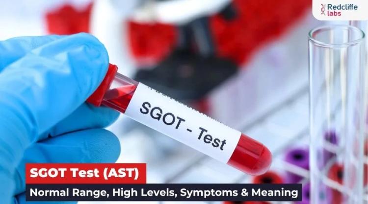 SGOT Test (AST): Normal Range, Purpose, Symptoms & Meaning