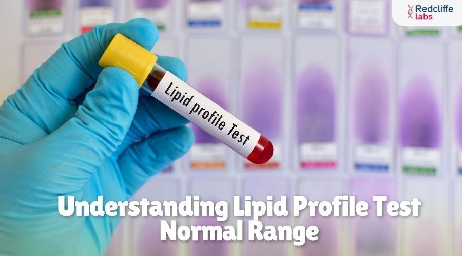 Understanding Lipid Profile Test Normal Range