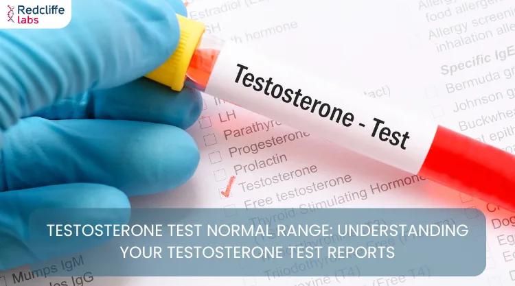 Testosterone Test Normal Range: Understanding Your Testosterone Test Reports