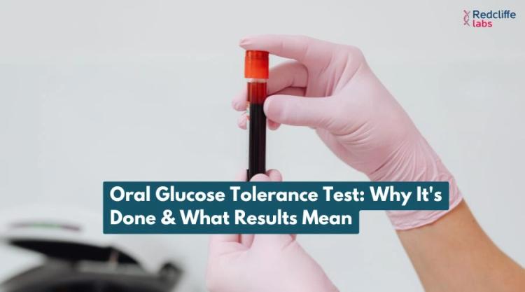 Oral Glucose Tolerance Test: Why It's Done & What Results Mean
