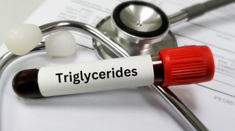 Triglycerides Meaning in Marathi: ट्रायग्लिसराइड्सचा अर्थ आणि महत्त्व