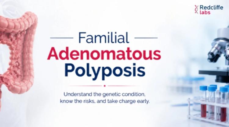 Familial Adenomatous Polyposis (FAP): Symptoms, Causes, Treatment & Genetic Testing