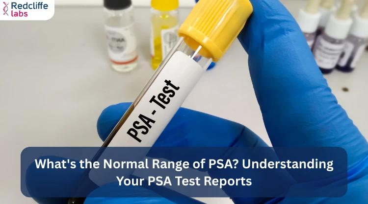 What's the Normal Range of PSA? Understanding Your PSA Test Reports