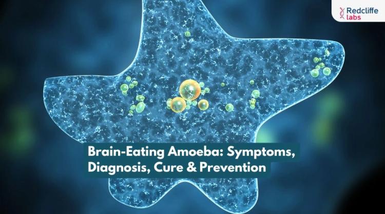 Brain-Eating Amoeba: Symptoms, Diagnosis, Cure & Prevention