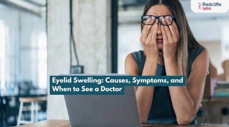 Eyelid Swelling: Causes, Symptoms, and When to See a Doctor