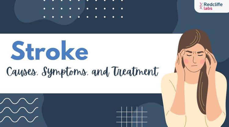Stroke: Causes, Symptoms, and Treatment