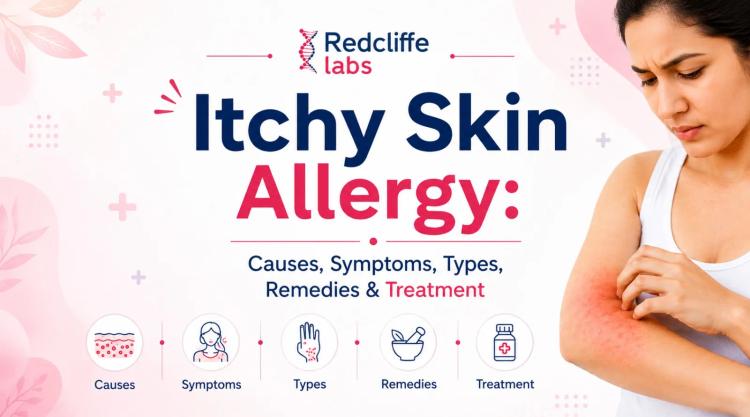Itchy Skin Allergy: Causes, Symptoms, Types, Remedies & Treatment