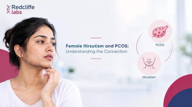 Female Hirsutism and PCOS: Understanding the Connection