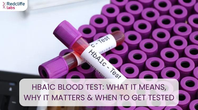 HbA1c Blood Test: What It Means, Why It Matters & When to Get Tested
