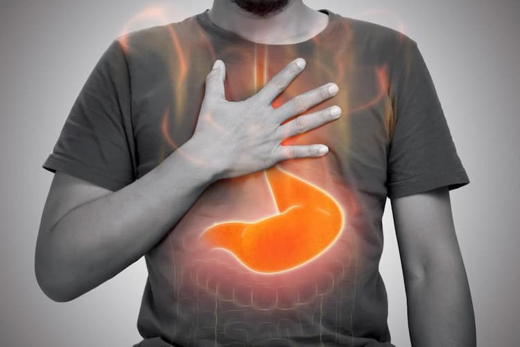 All about Acid Reflux: Causes, Symptoms & Solution