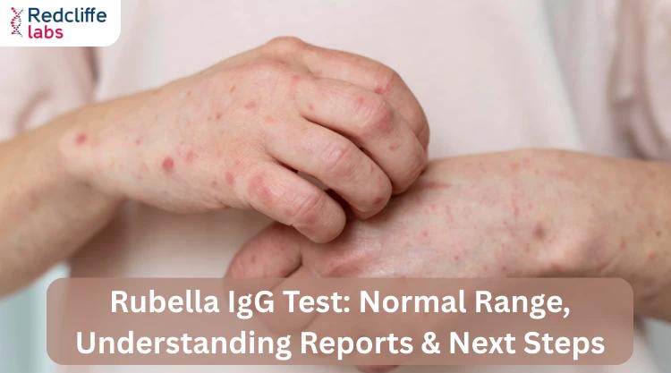 Rubella IgG Test: Normal Range, Understanding Reports & Next Steps