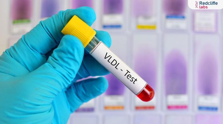 Vldl Cholesterol in Hindi: इसके महत्व, प्रक्रिया और परिणामों को जानें