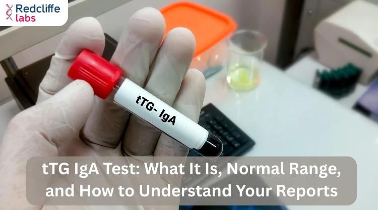 tTG IgA Test: What It Is, Normal Range, and How to Understand Your Reports