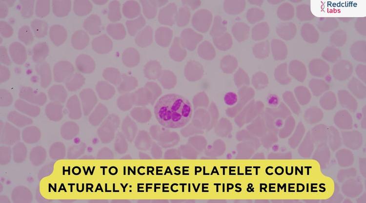 How to Increase Platelet Count Naturally: Effective Tips & Remedies