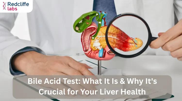 Bile Acid Test: What It Is & Why It's Crucial for Your Liver Health