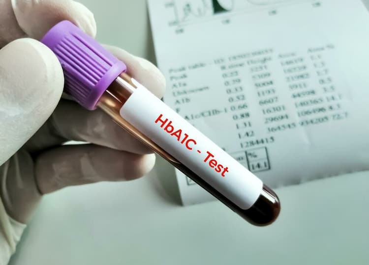 Hba1c Test in Hindi: महत्व परिणाम तथा टेस्ट रिजल्ट