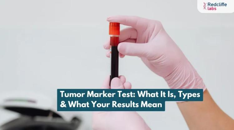 Tumor Marker Test: What It Is, Types & What Your Results Mean