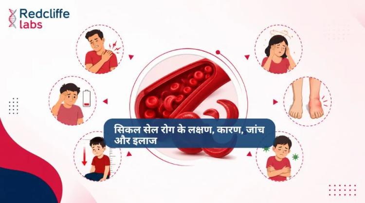 सिकल सेल रोग के लक्षण, कारण, जांच और इलाज