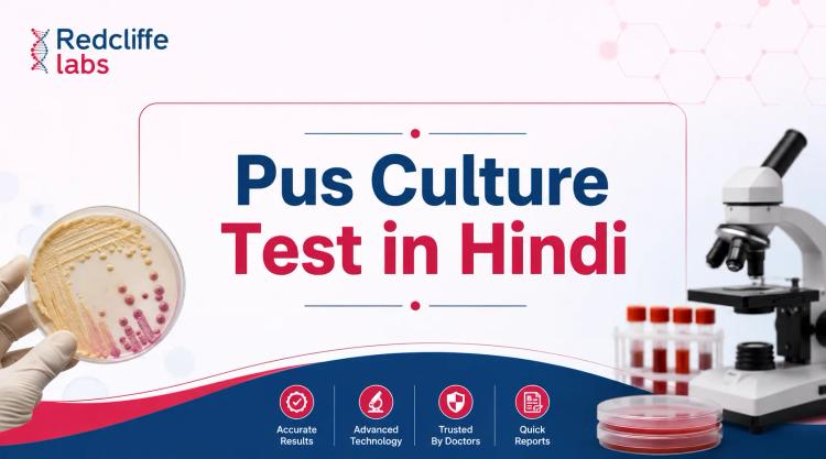 Pus Culture Test in Hindi: मतलब, प्रक्रिया, रिपोर्ट और कीमत
