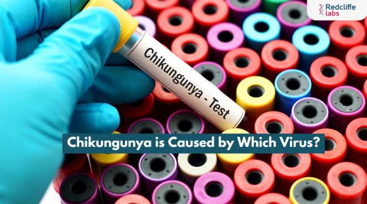 Chikungunya is Caused by Which Virus?
