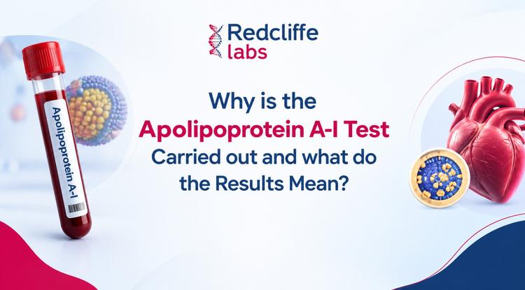 Why is the Apolipoprotein A-I Test Carried out and what do the Results Mean?