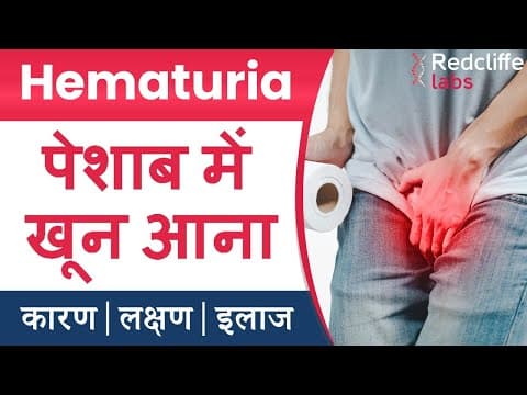 Hematuria (पेशाब में खून आना ) Symptoms And Causes in Hindi | Hematuria (Blood in Urine) का इलाज