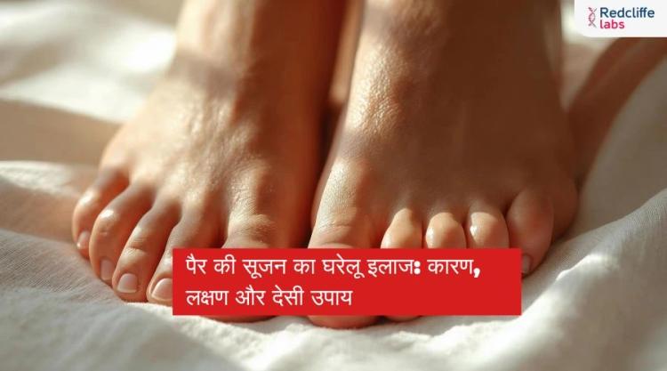 पैर की सूजन का घरेलू इलाज: कारण, लक्षण और देसी उपाय