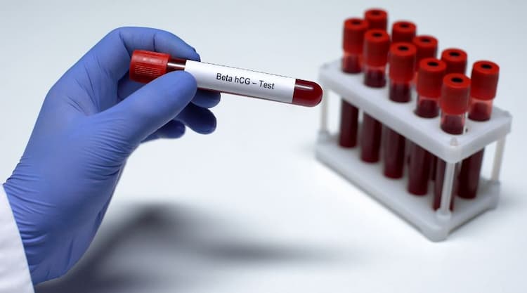 10 Factors Affecting HCG Beta Test Results