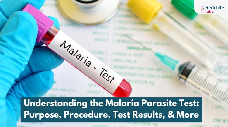 Understanding the Malaria Parasite Test: Purpose, Procedure, Test Results, & More