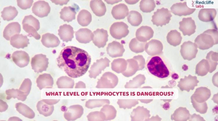 What Level of Lymphocytes Is Dangerous?