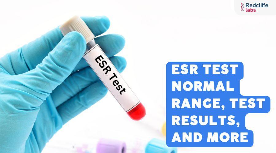 ESR Test Normal Range Test Results And More Esr test normal range test results and more