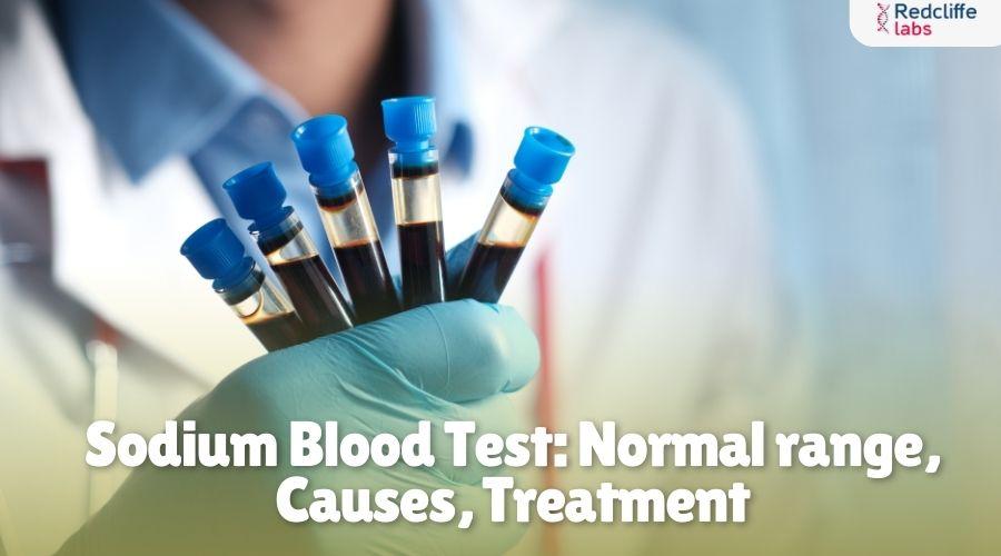 Sodium Lab Test Sodium Normal Range, Need, Procedure, & More
