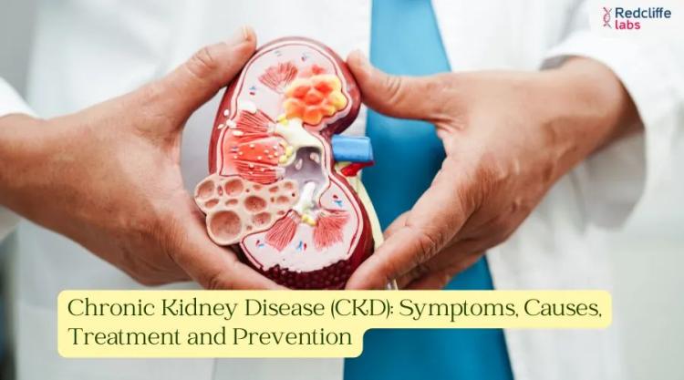 Chronic Kidney Disease (CKD): Symptoms, Causes, Treatment and Prevention