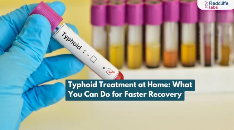 Typhoid Treatment at Home: What You Can Do for Faster Recovery