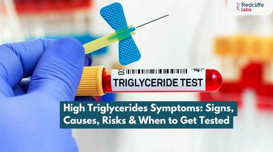 https://myhealth-redcliffelabs.redcliffelabs.com/media/blogcard-images/None/e506fdf0-659b-4d51-9d62-d184fc9eb4a4.webp