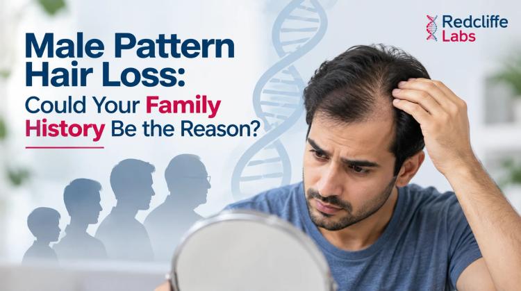 Male Pattern Hair Loss: Could Your Family History Be the Reason?