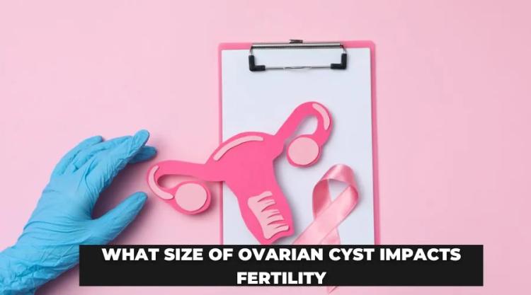 What Size of Ovarian Cyst Impacts Fertility?
