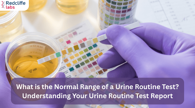 What is the Normal Range of a Urine Routine Test? Understanding Your Urine Routine Test Report