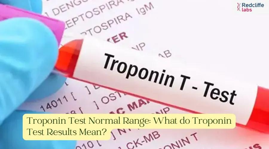 Troponin Test